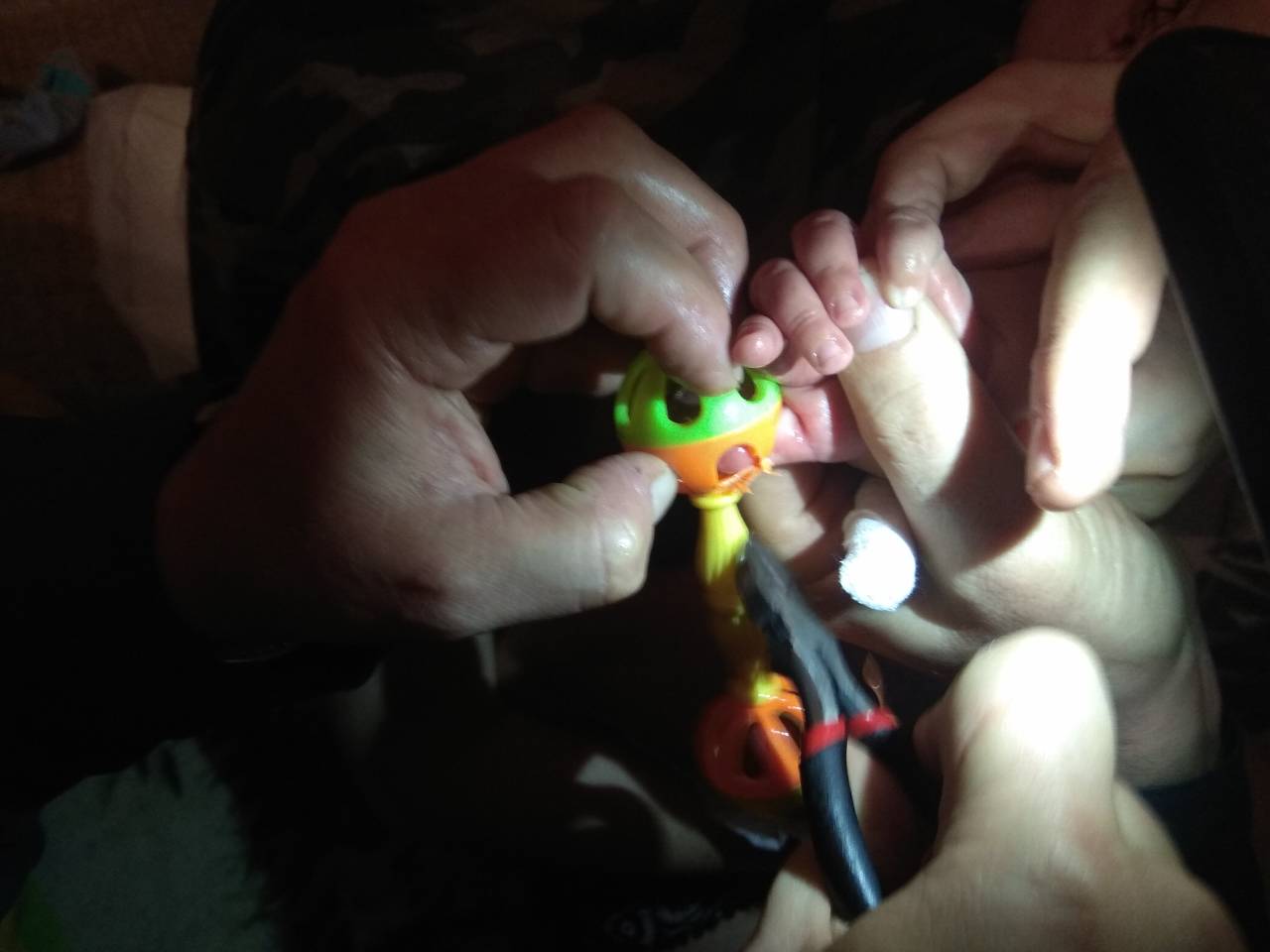 У 3-х месячной девочке палец застрял в игрушке: спасатели пришли на помощь