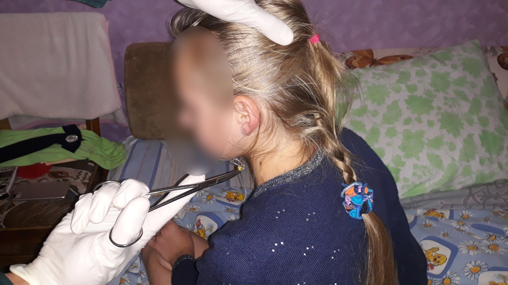 У 12-летней девочки застряла сережка в ухе. Понадобилась помощь спасателей